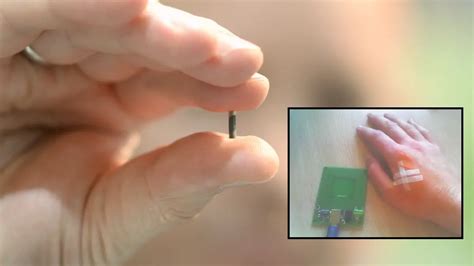 rfid tag under skin|rfid chip implants.